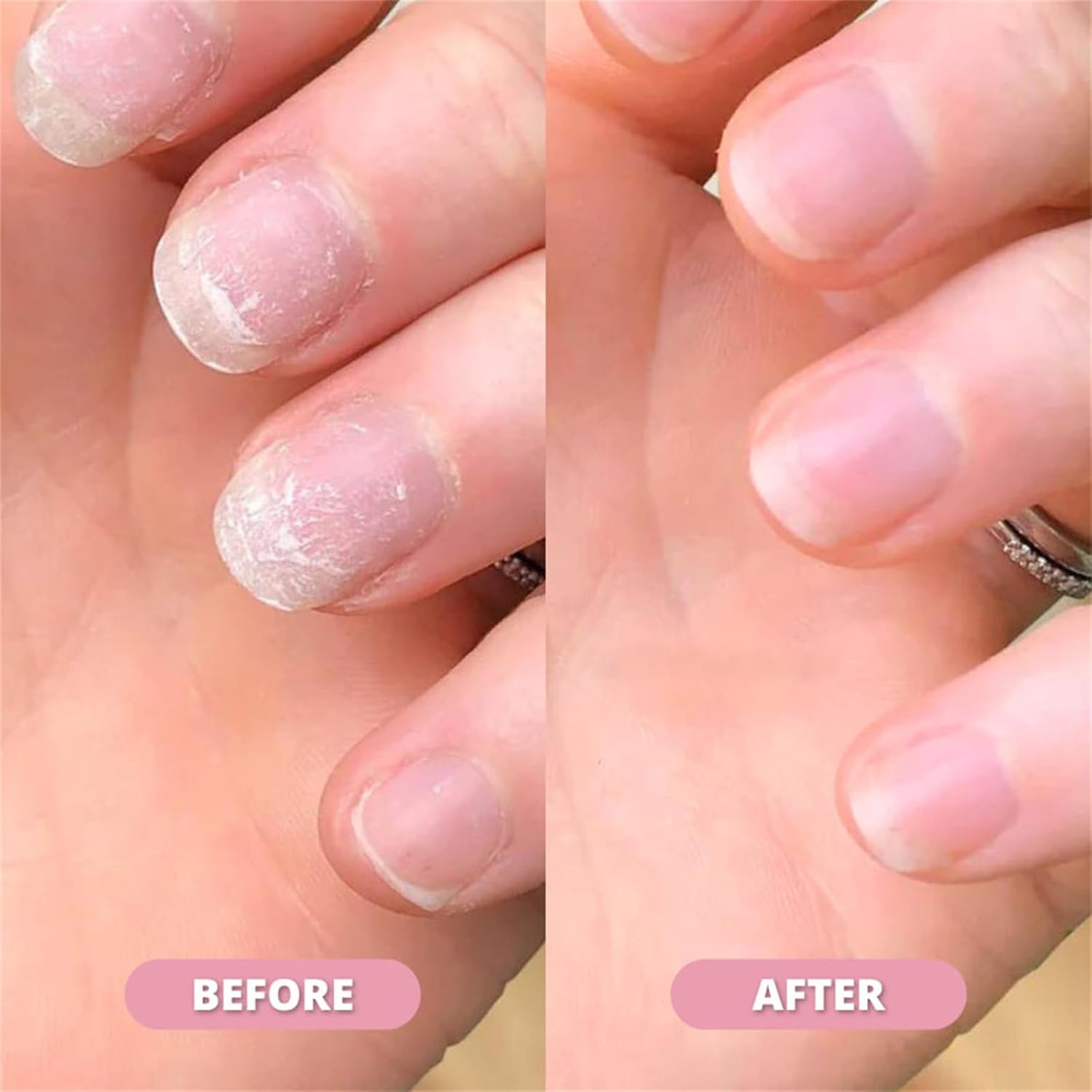 Nail Growth & Cuticle Oil Pen Radiant Serum Nutrient Pen for Moisturizing, Strengthening & Brightening Nails